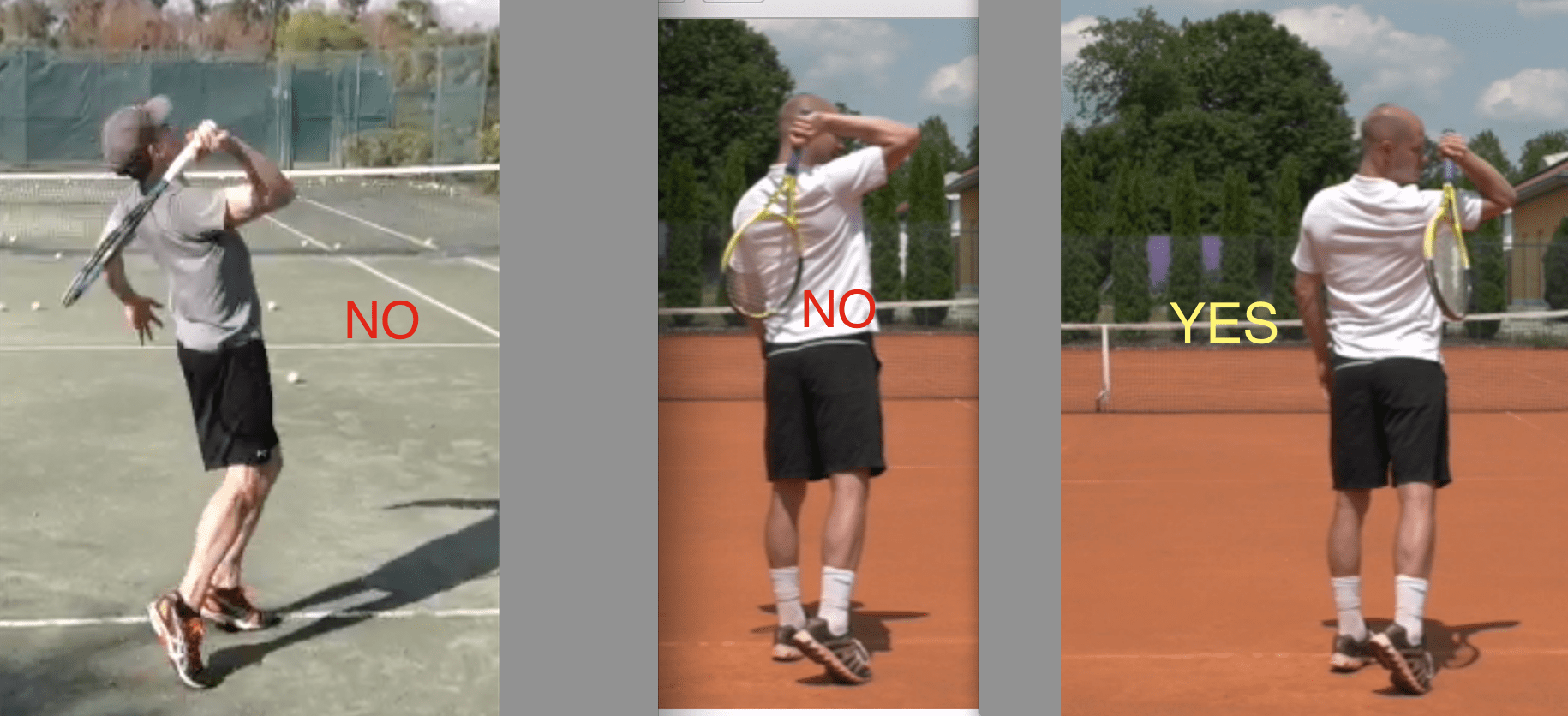 Dropping racket on serve = tennis elbow Talk Tennis
